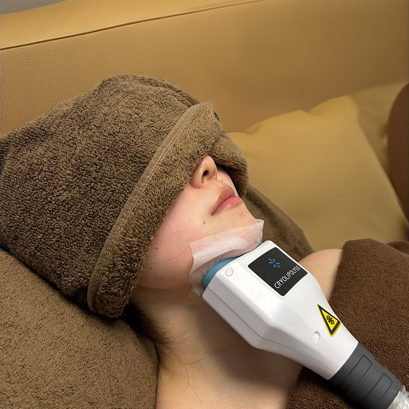 あご脂肪冷却の施術シーン