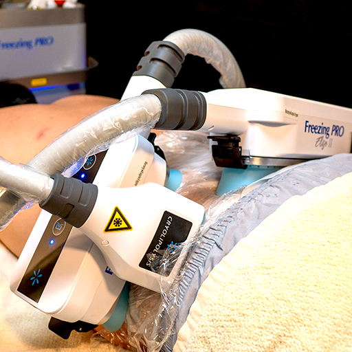 男性脂肪冷却イメージ1