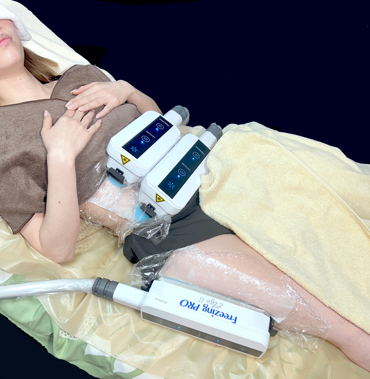 脂肪冷却カップ装着