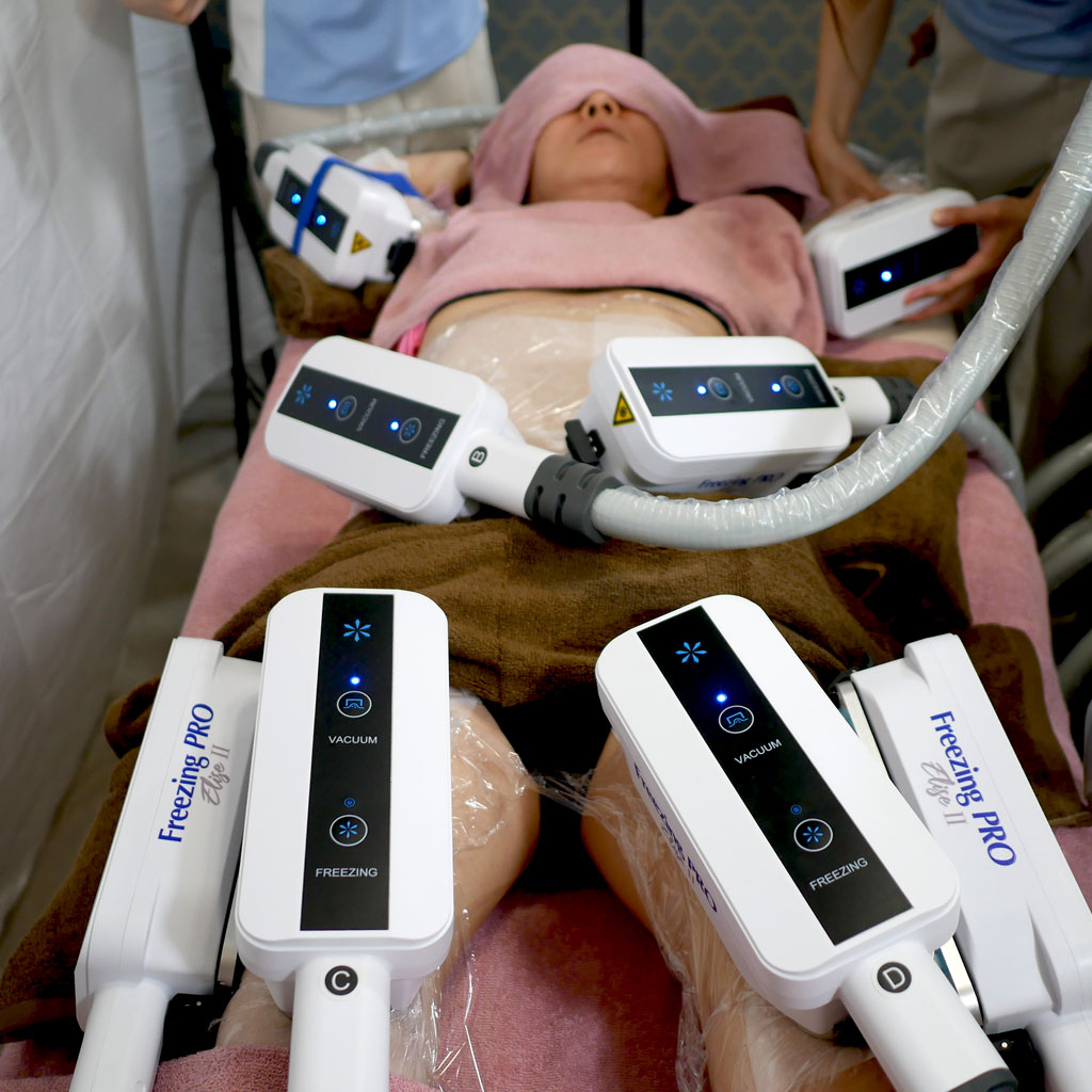 全身8部位脂肪冷却